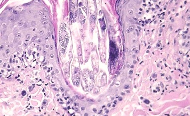 LAPVSOFr2007-10-10_0003