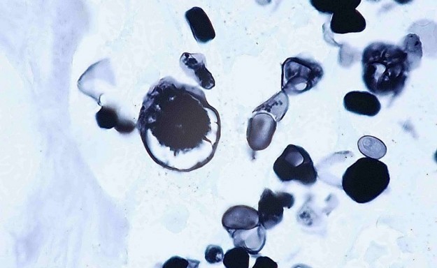 LAPVSOFr2008-03-06_0003