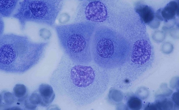 LAPVSOFr2008-07-08_0015