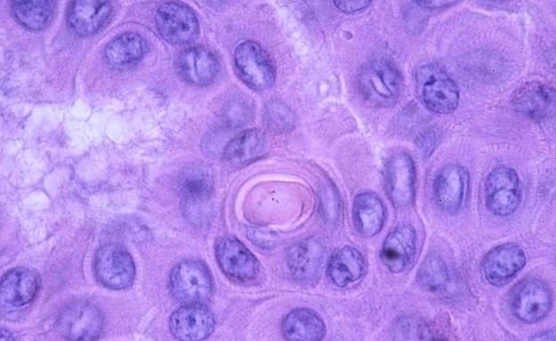 LAPVSOFr2010-03-03_0025