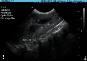 Photo 3 : échographie rénale. La corticale est hyperechogène, le rapport cortico-medullaire est dans les normes. Photo Dr M. Mahinc.