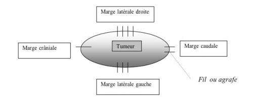 tumeur_marges_2